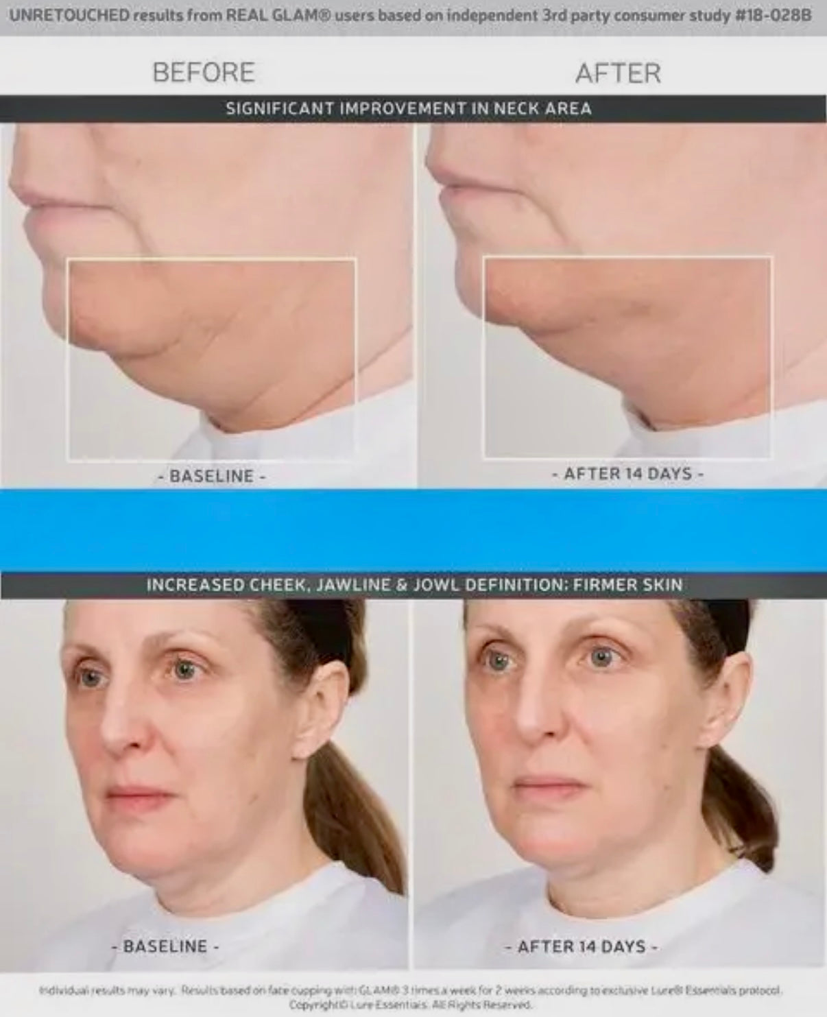 Facial Rejuvenation Massage CUPPING SET (Lips, Face, Eyes, Neck)